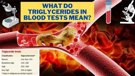 triglyceride test from drop of blood|triglyceride blood test high meaning.